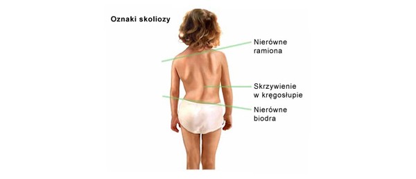 BEZPŁATNE badania kręgosłupa dla dzieci naszej gminy